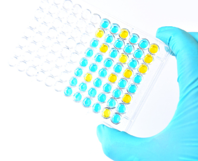 ASSAY DEVELOPMENT