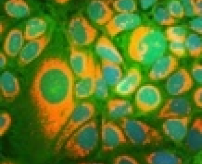 YFV NS1 Mab BF-087-100ug