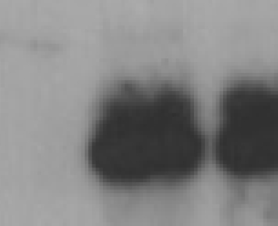 ZIKA VIRUS NS1 MONOCLONALS