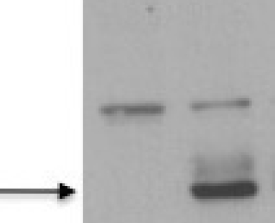 ZIKA VIRUS NS1 ANTIGEN