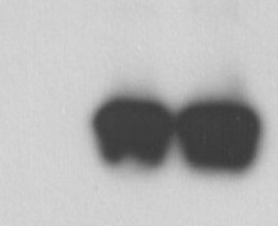 ZIKA VIRUS ENVELOPE ANTIGEN