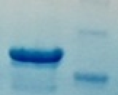 ZIKA VIRUS NS5 ANTIGEN