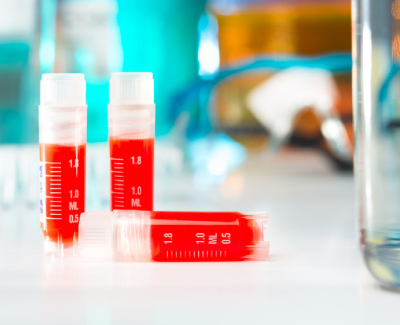 CUSTOM MONOCLONAL ANTIBODY DEVELOPMENT